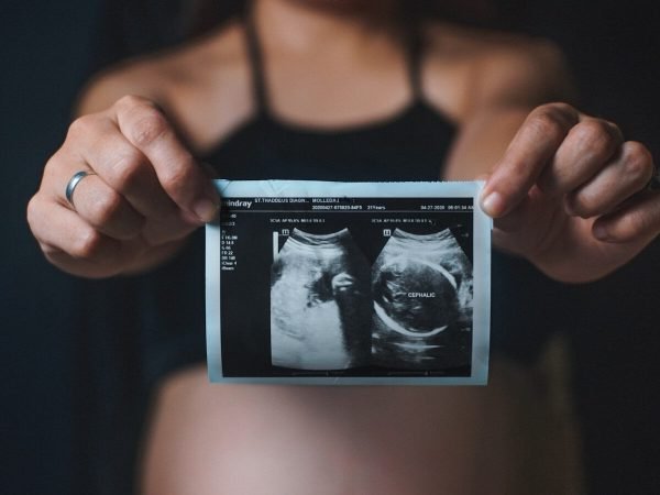 Understanding Infertility: Causes, Diagnosis & Treatment